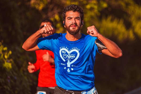 Was sind die besten Tipps gegen Schwangerschaftsstreifen?